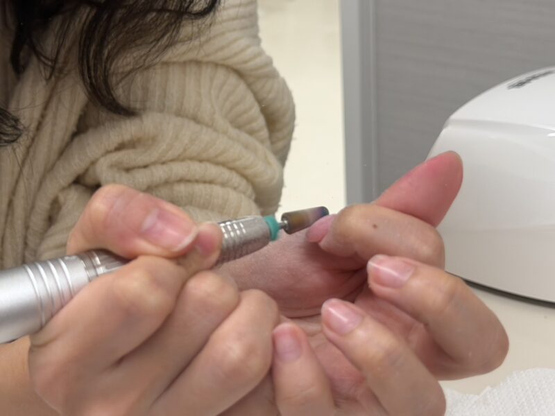 効率が良い施術